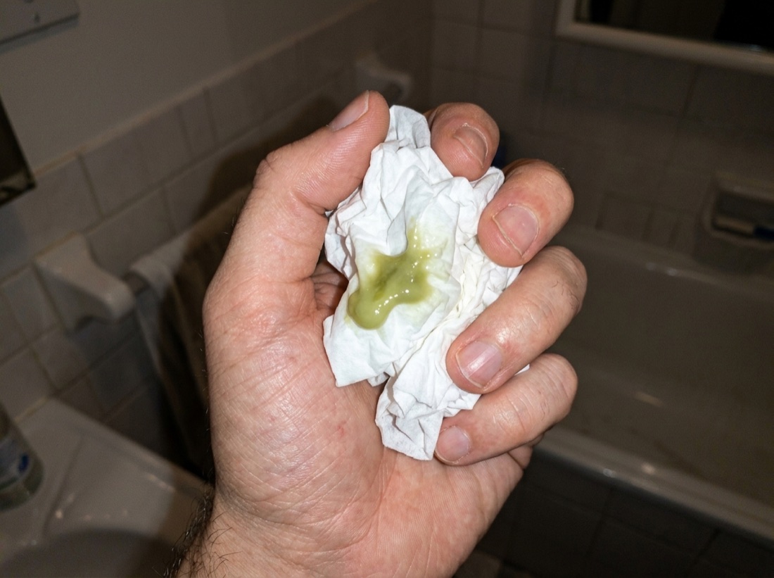 A used tissue showing loosened mucus